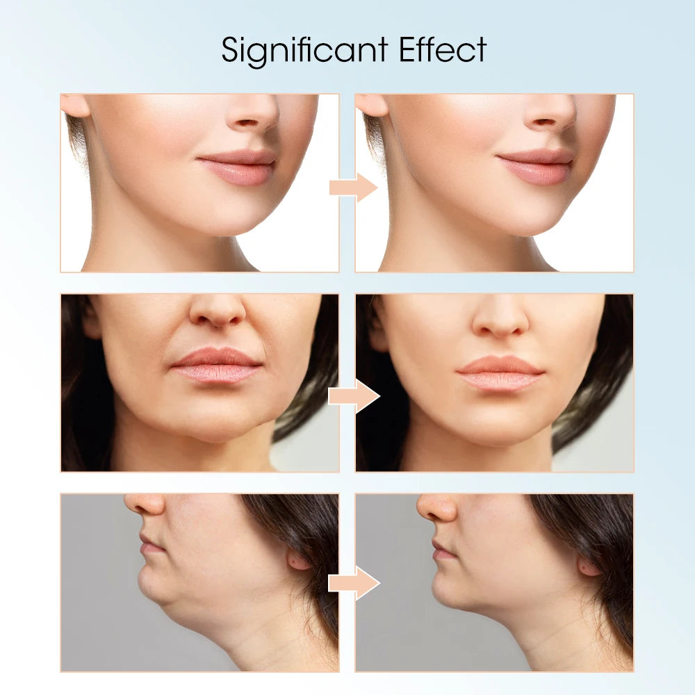 Cosmé Zen – Appareil Lifting Visage V-Face | Vibrations & écran LED Rechargeable